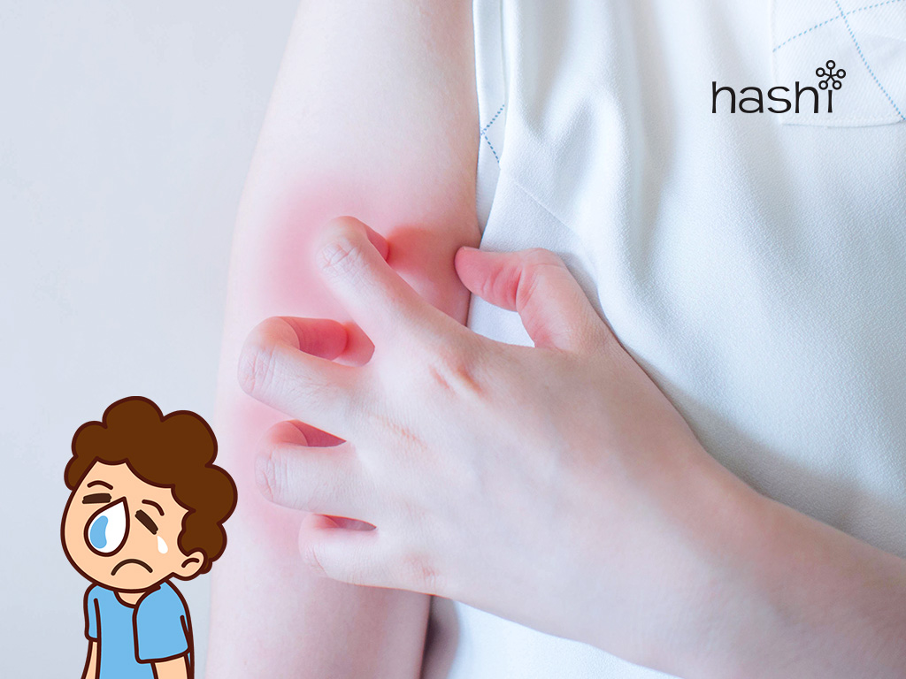 ภูมิแพ้ทางผิวหนัง 